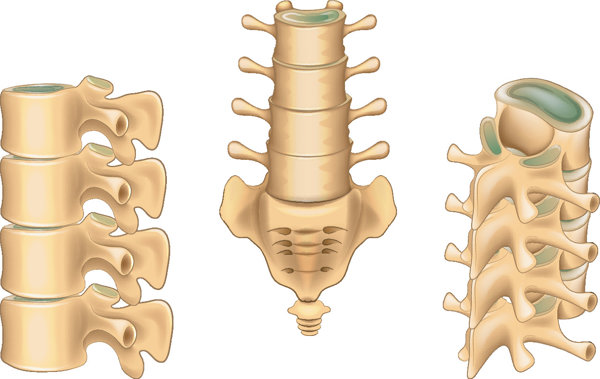 颈椎间盘突出与腰椎间盘突出的区别