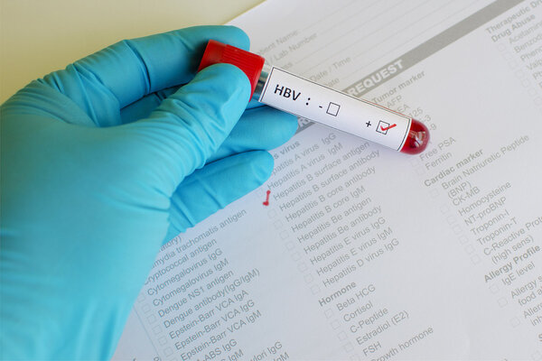 小孩乙肝病毒表面抗体